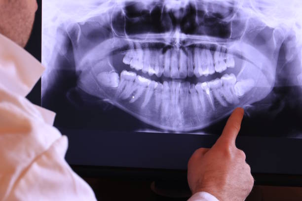 Best Emergency Broken Tooth Repair in Csar Chvez, TX